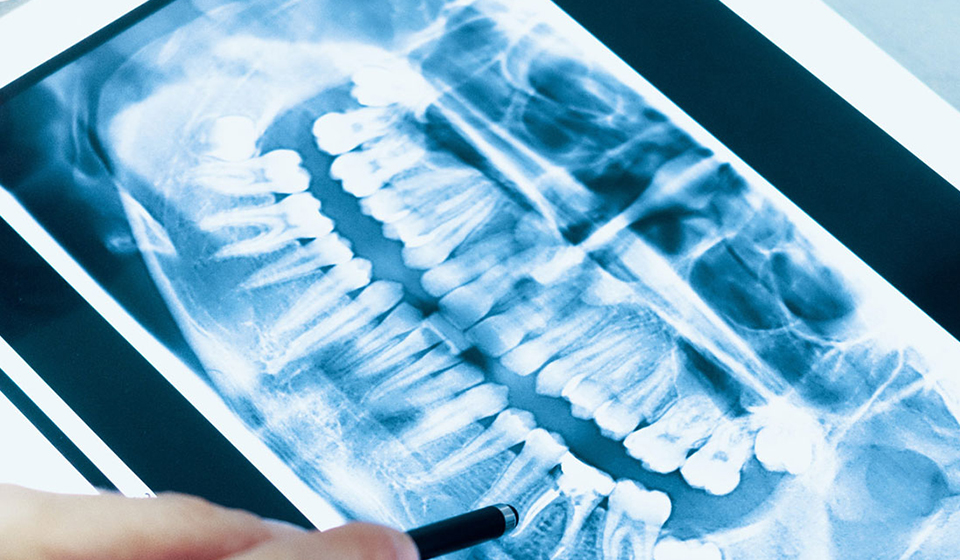 Digital X-Ray