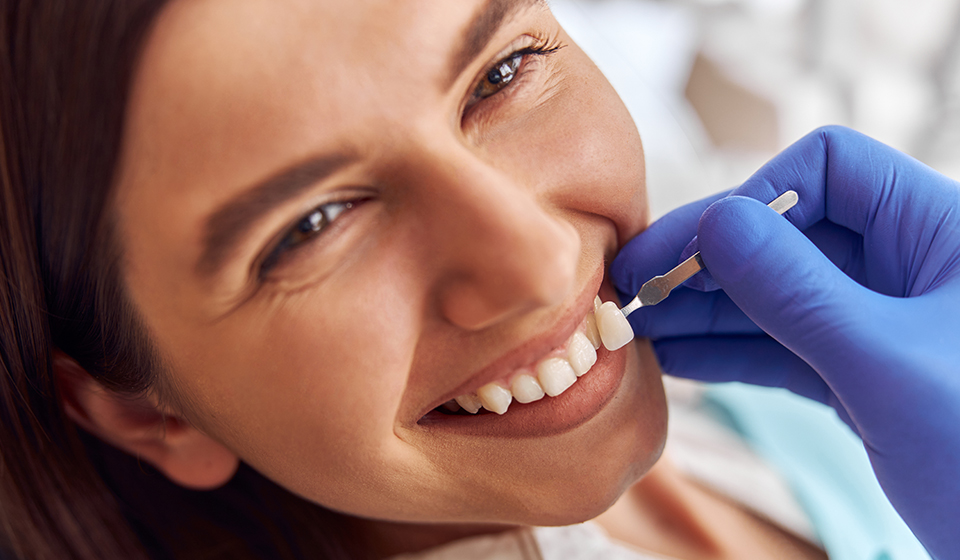 Dental Veneers